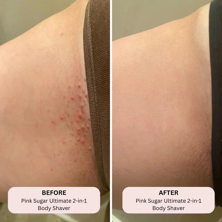 DEFINITIVE BIKINI TRIMMER - VAOCOM™